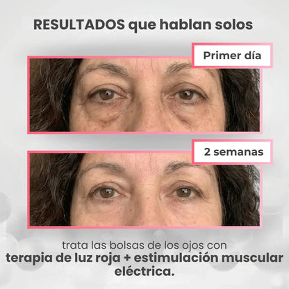 DermiaEyes® Reduce bolsas y ojeras en solo 10 minutos al día