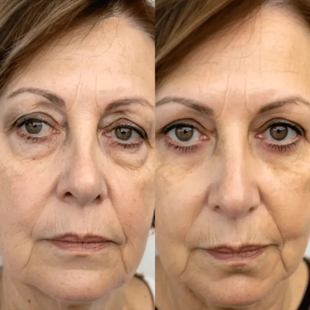 DermiaEyes® Reduce bolsas y ojeras en solo 10 minutos al día