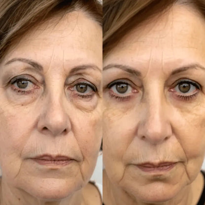 DermiaEyes® Reduce bolsas y ojeras en solo 10 minutos al día